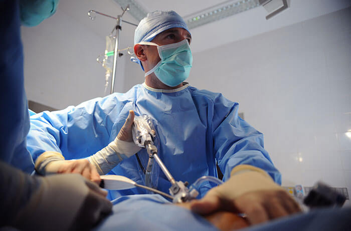 LAPAROSCOPIC SURGERY