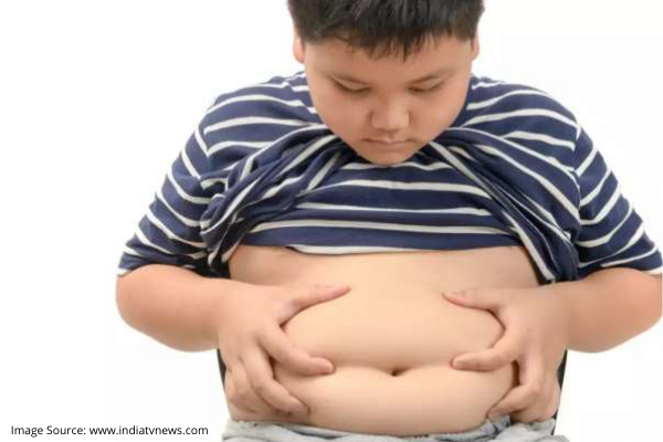 COMMON CAUSES OF CHILDHOOD OBESITY