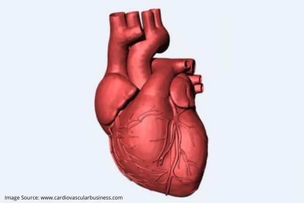 How to Prepare for an Angiogram