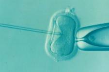 INFERTILITY AND ITS MAJOR CAUSES AND TREATMENTS