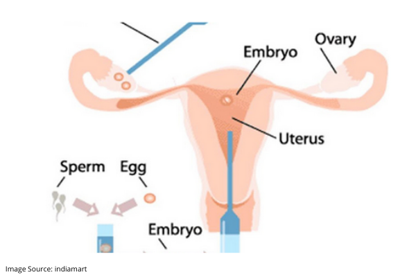 ivf treatment success rates