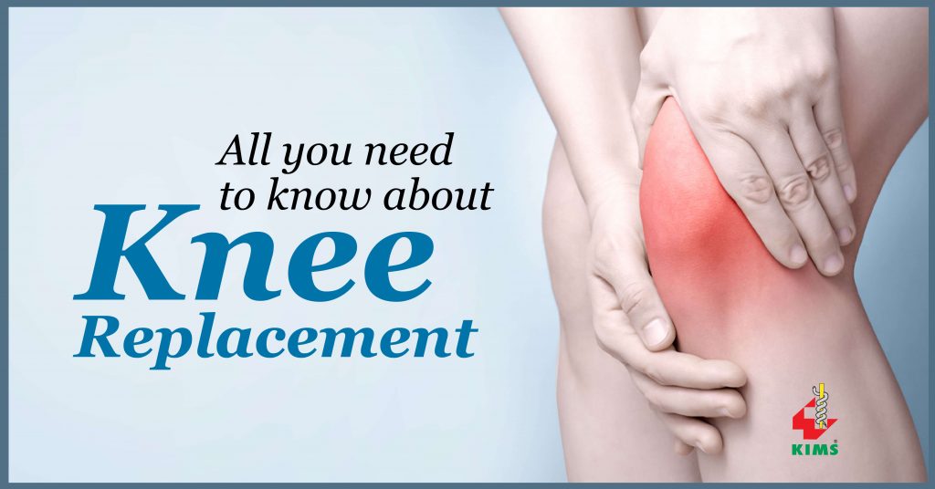 Knee replacement surgery