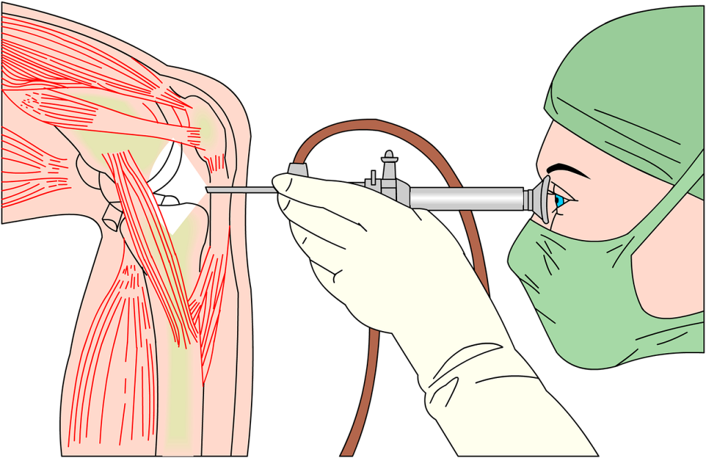 Risks Of Total Knee Replacement Surgery