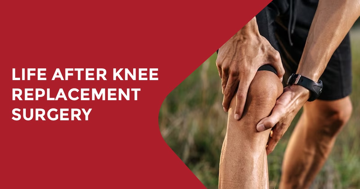 Understanding Knee Replacement Surgery