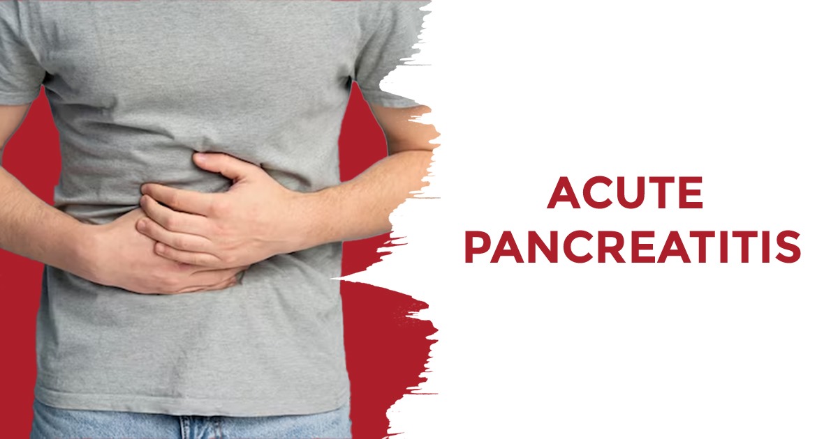 A Deep Dive into the Triggers and Identification of Repeated Acute Pancreatitis