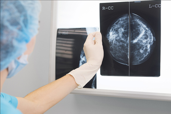 ULTRASOUND ELASTOGRAPHY IN EVALUATION OF BREAST MA