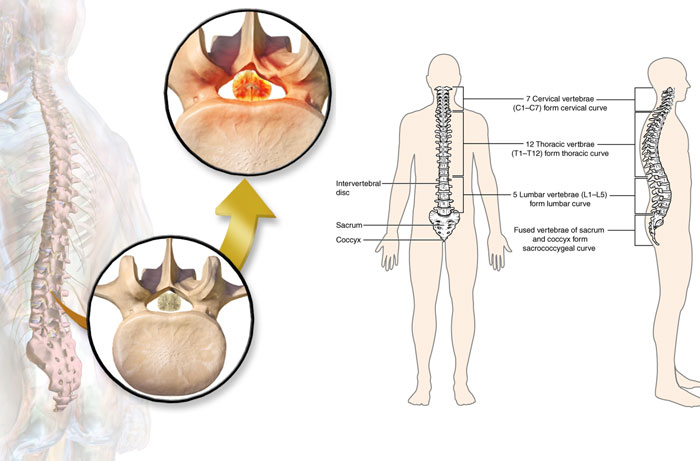 WHAT IS SPINAL DECOMPRESSION?